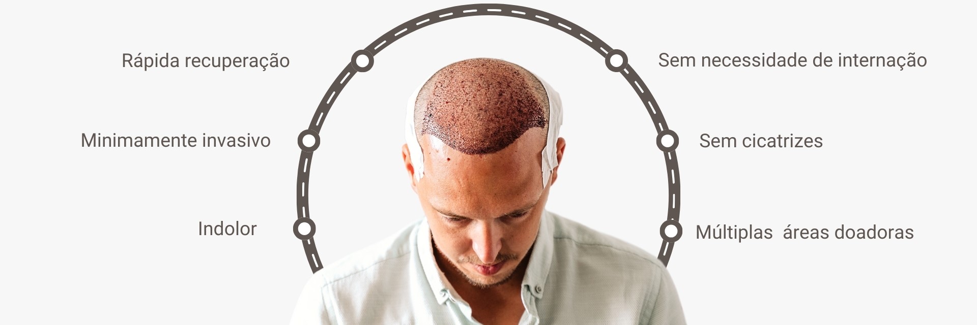 Técnica FUE 2 Indolor. 3 1