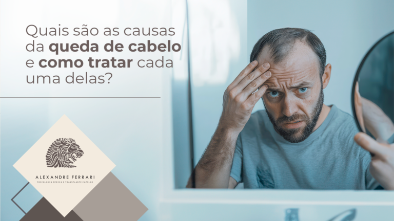 231024 alexandre blog